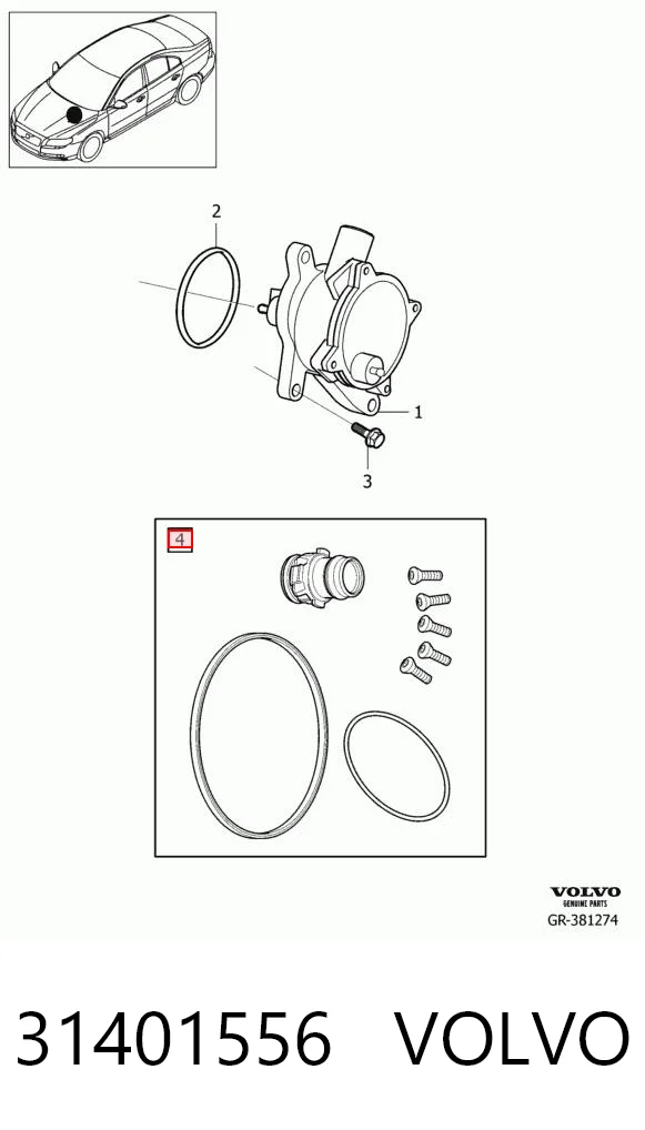 31401556 Volvo Juego de reparación de bomba de vacío